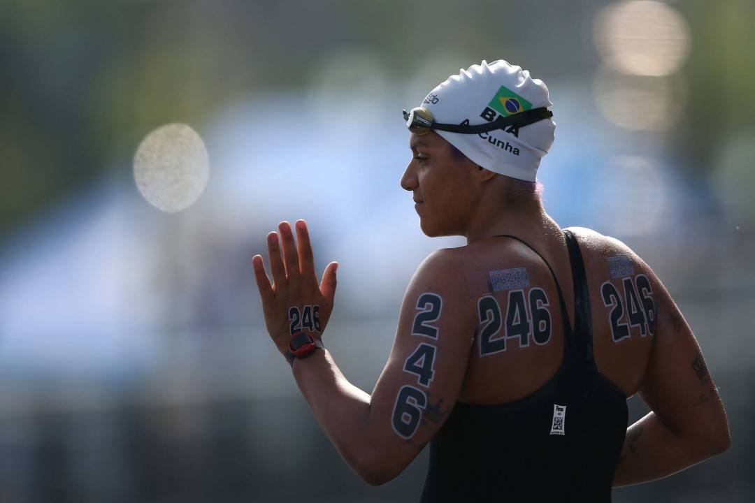 Ana Marcela Cunha Undergoes Shoulder Surgery, Says She’ll Be Stronger In 2023