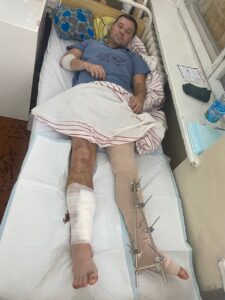 Ukrainian Swimmer Igor Chervynskiy, 3x World Championship Medalist, Injured in War with Russia