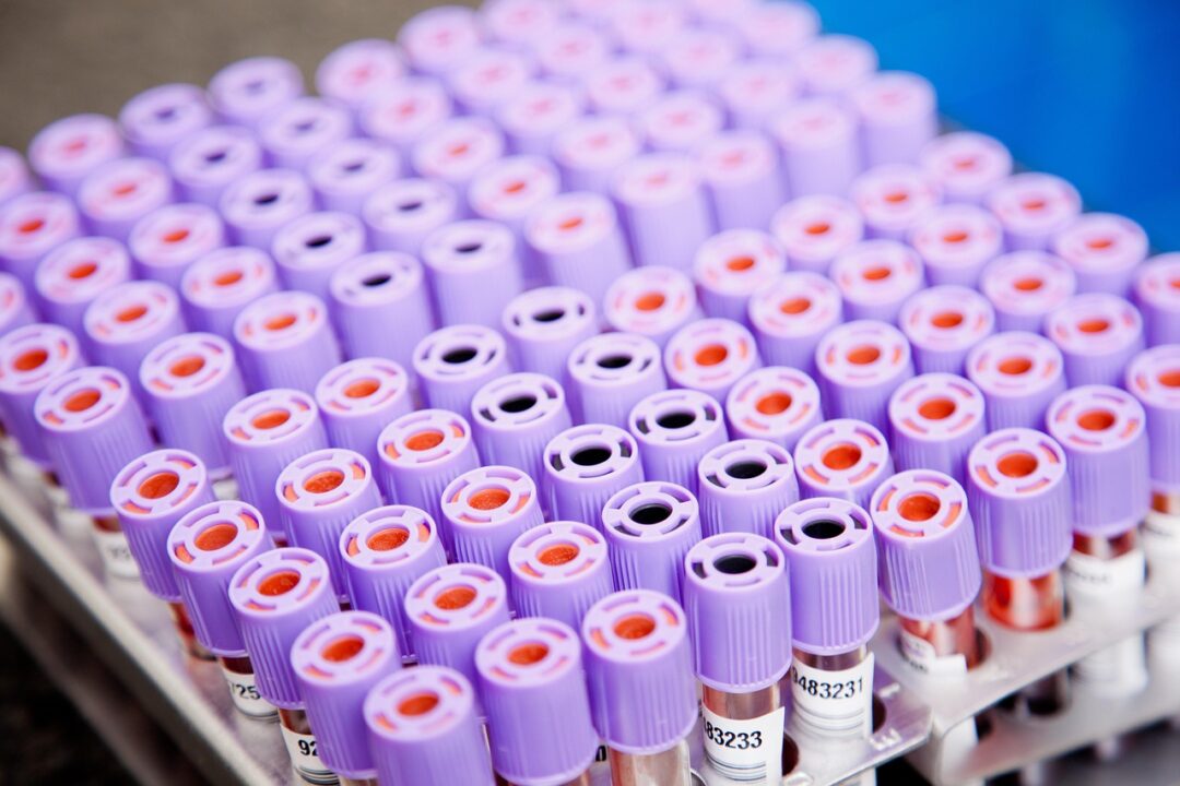 Russia Hands Doping Suspensions to a Pair of National Level Swimmers